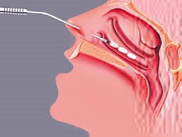 Traitement ORL des pathologies du nez et des sinus | ORL 31